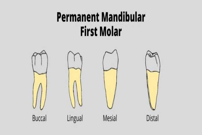 Techniques for Creating a Mandibular Molar Access Opening