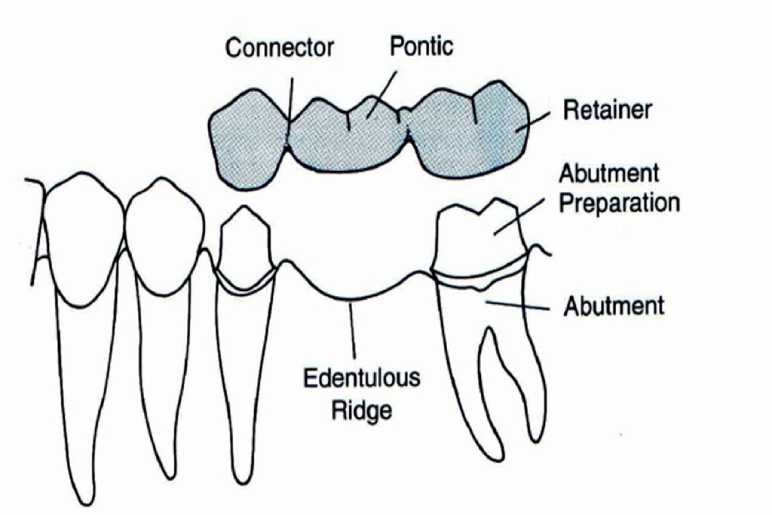 Factors Influencing Ante's Law