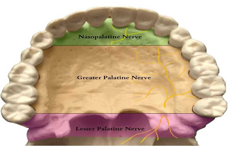 Performing the Greater Palatine Nerve Block