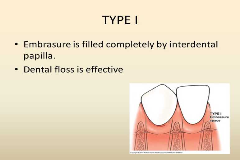 What Are Embrasures?